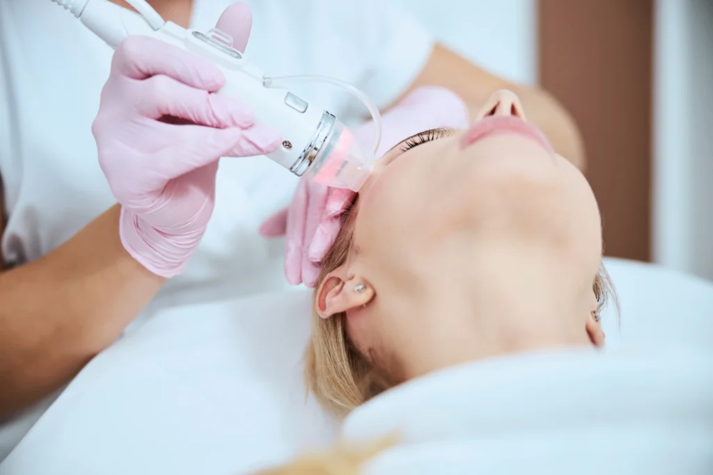MaisonDestetica Microneedling 2